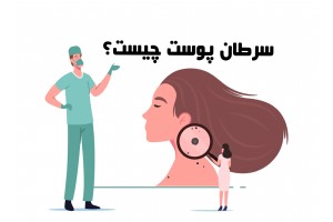 هر آنچه باید درباره‌ی سرطان پوست بدانید
