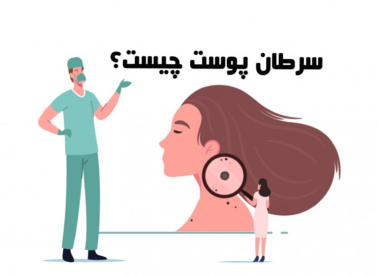 هر آنچه باید درباره‌ی سرطان پوست بدانید